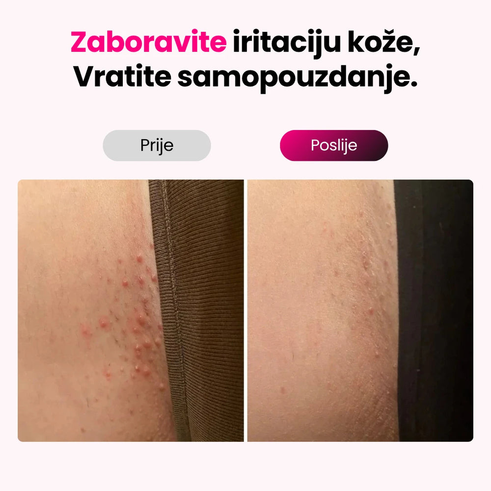 Elumi™ Skin PRO IPL fotoepilator