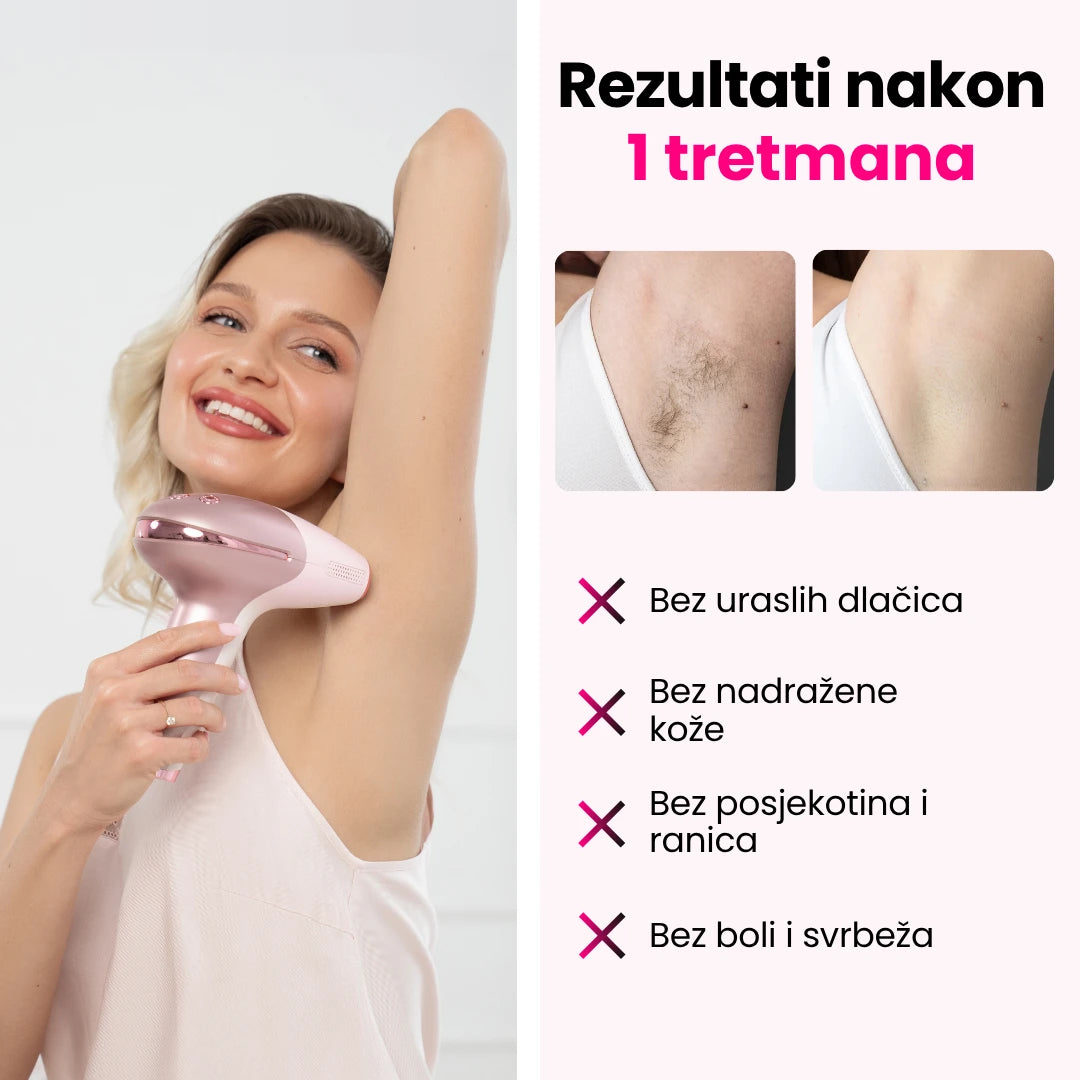 Elumi™ Skin PRO IPL fotoepilator