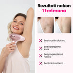 Elumi™ Skin PRO IPL fotoepilator