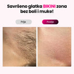 Elumi™ Skin PRO IPL fotoepilator